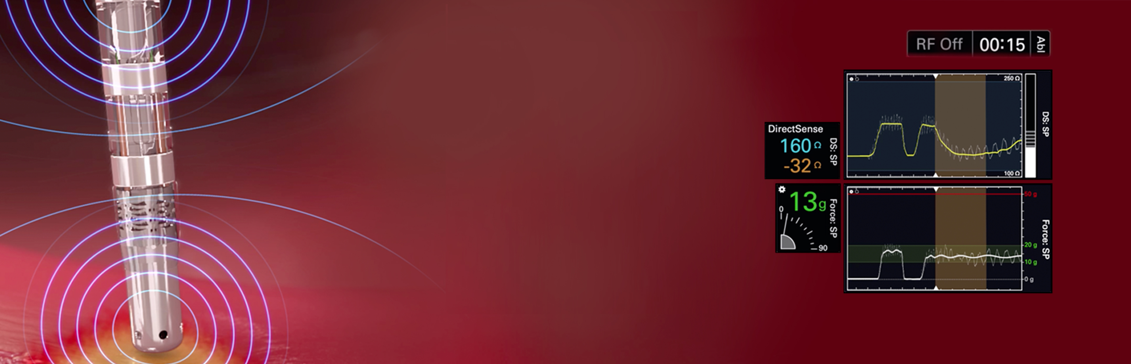 Cardiac Ablation Catheters INTELLANAV STABLEPOINT™ Boston Scientific